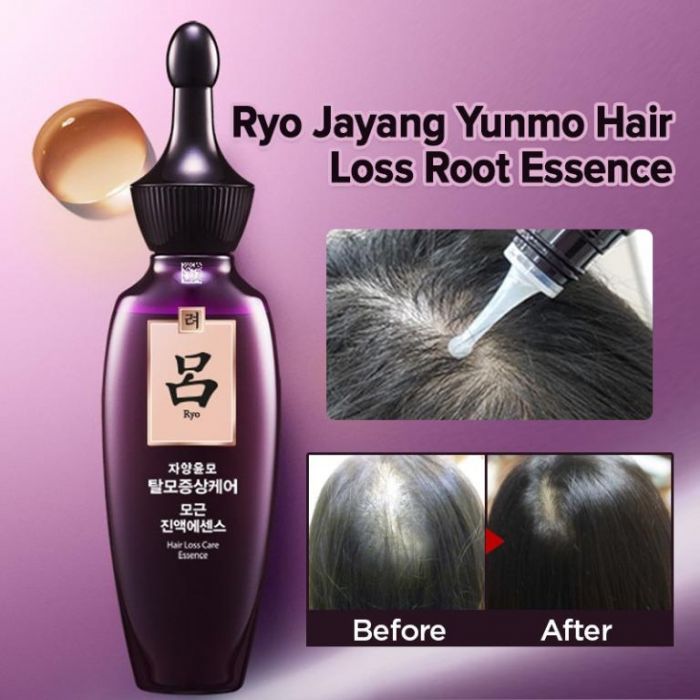 Ryo Hair Loss Care Essence (GinsenEX) 75ml - Skin Care BD